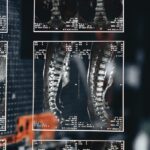 Automatizált gerinc MR leletező és vizualizált leletértelmező rendszer