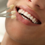 cirkon korona fogászat